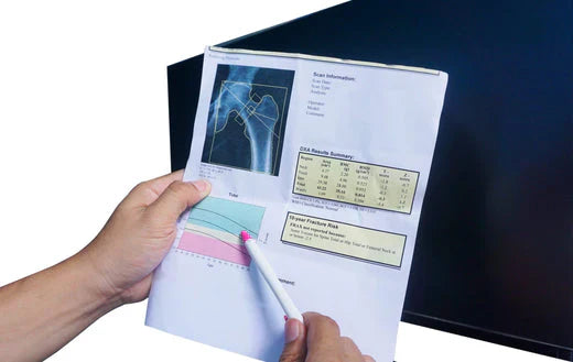 Osteopenia e osteoporose: como se diferenciam?